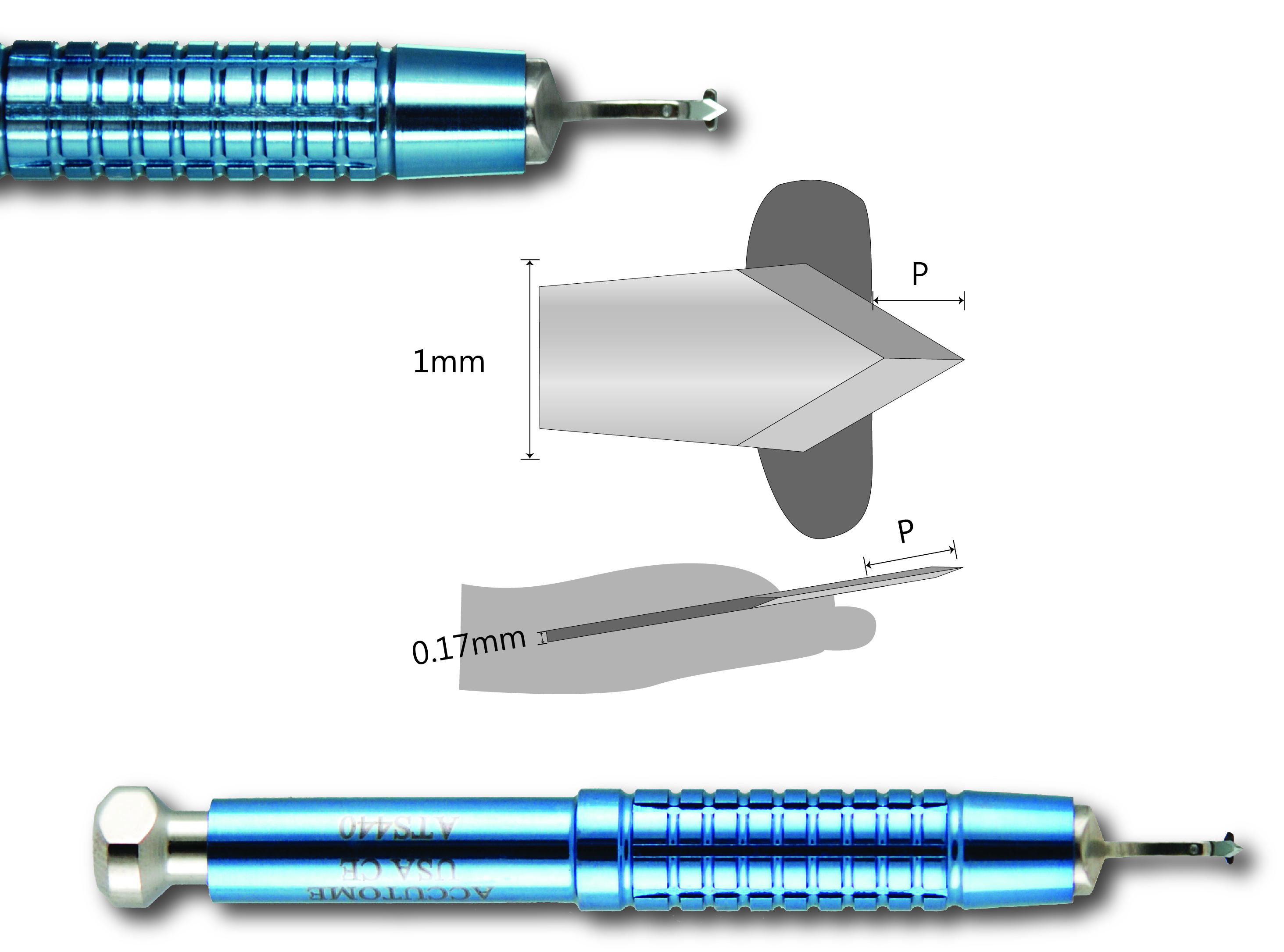 Donnenfeld Preset Truncated Lancet, Short Handle AK6160SPT300